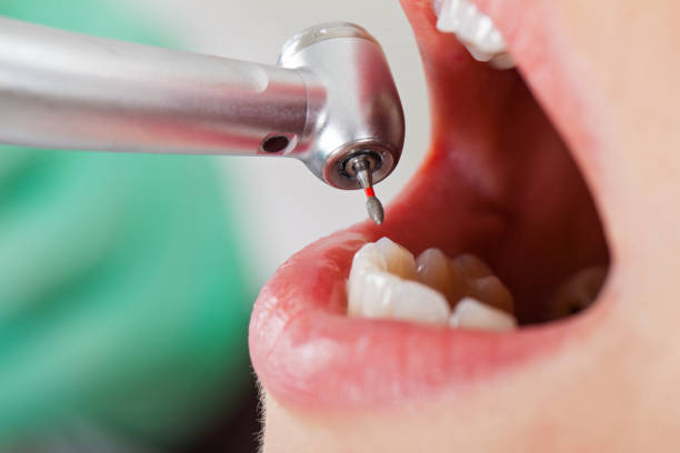Best Emergency Tooth Extraction in Somers, WI